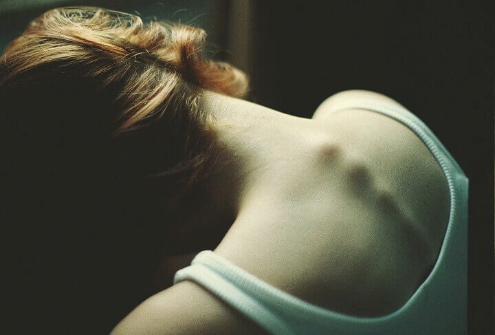 Anorexie: Wenn Magerkeit nur die Spitze des Eisbergs ist