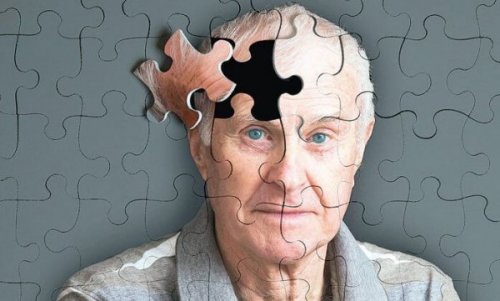 5 Warnzeichen für Morbus Alzheimer