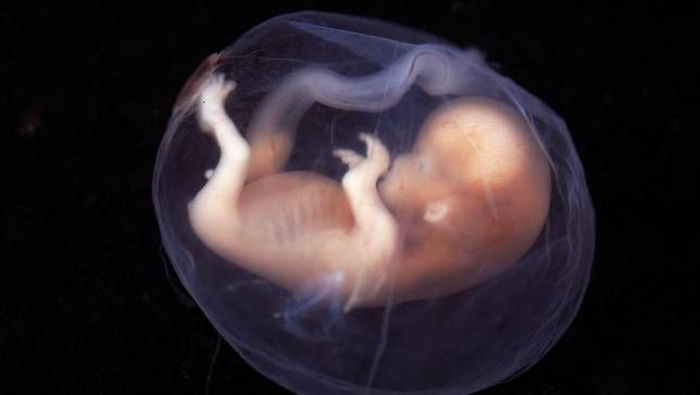Embryo liegt im Fruchtwasser