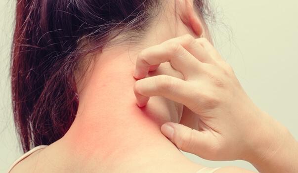 In welchem Zusammenhang stehen eine atopische Dermatitis und Stress?
