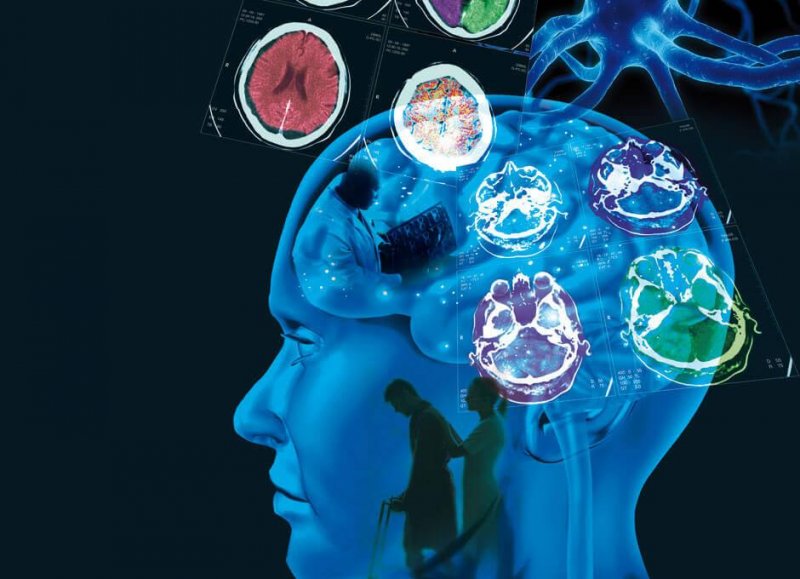 Multiple Sklerose: Ursachen, Symptome und Behandlung