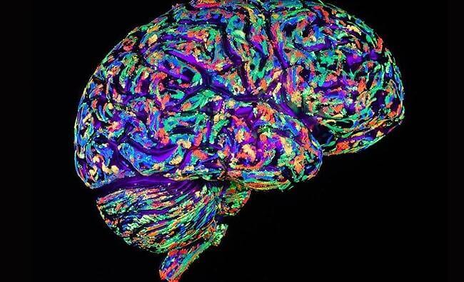 Querschnitt durch ein menschliches Gehirn in Leuchtfarben.