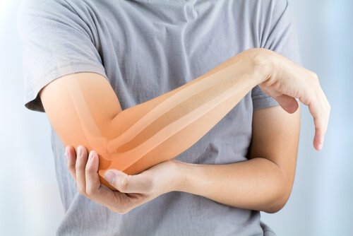 Rheumatoide Arthritis: Symptome, Ursachen und Behandlung