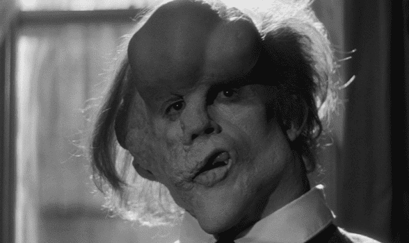 Der Elefantenmensch: Ein Drama über die Würde des Menschen