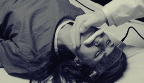 Elektroschocktherapie bei einer Frau