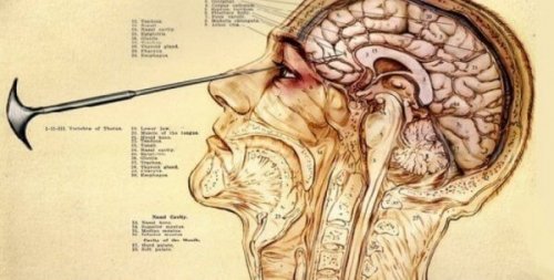 Bildliche Darstellung einer Lobotomie