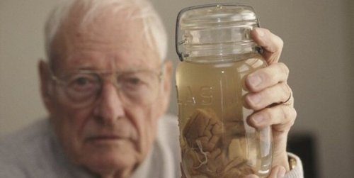 Thomas Harvey mit Albert Einsteins Gehirn