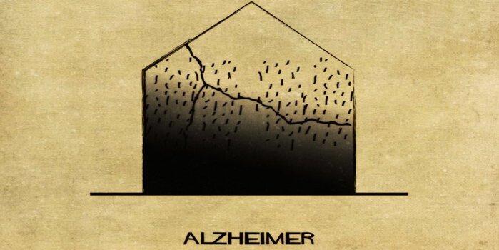 Alzheimer vom italienischen Architekten Balbina dargestellt.