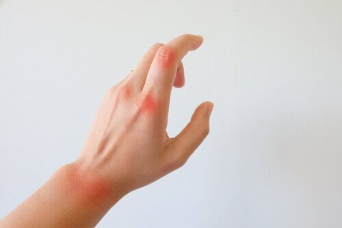 Hand mit rot markierten Gelenken