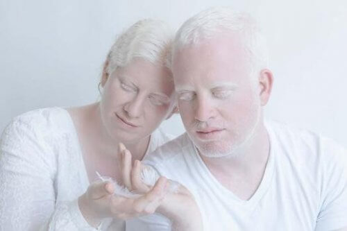 Albino-Paar