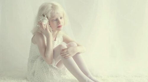 Mädchen mit Albinismus