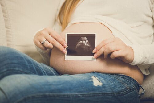 Eine Schwangere hält das Foto ihres Ultraschalls vor ihren Bauch. 