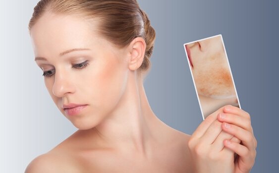 Die Spiegeltherapie kann helfen, wenn man sein Spiegelbild nicht mag und den eigenen Körper verzerrt wahrnimmt.