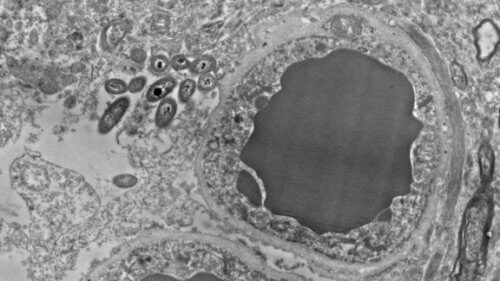 Gehirn-Mikrobiom: Darmbakterien in unserem Gehirn