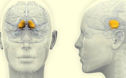 Eine Illustration, die die Basalganglien im Gehirn hervorhebt, einem der Hauptteile, auf die sich die progressive supranukleäre Lähmung auswirkt.