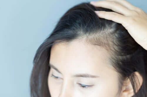 Die psychologischen Auswirkungen von Alopezie bei Frauen