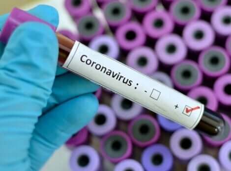 Impfungen gegen Panik in Zeiten des Coronavirus