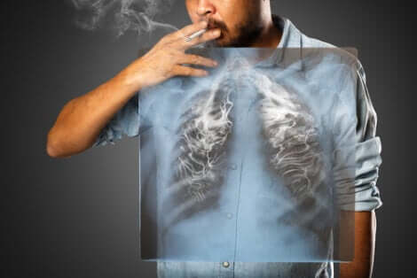 Erhöht der Tabakkonsum die Gefahr für Komplikationen bei einer Covid-19-Infektion?