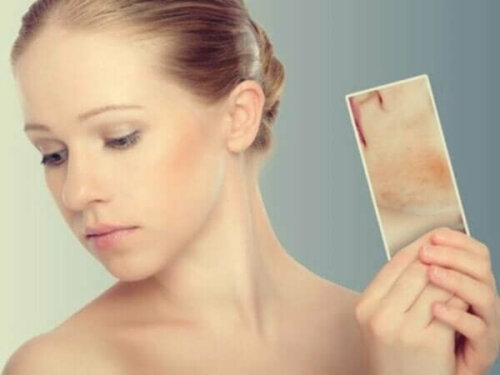 Stressbedingte Hautausschläge und Flecken: Wenn deine Haut auf deine Emotionen reagiert