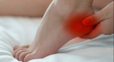 Burning-Feet-Syndrom - Frau fasst sich an die Ferse