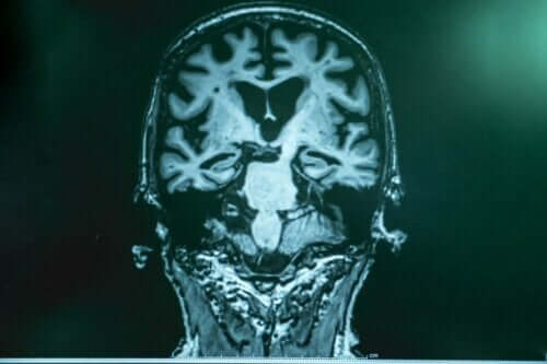 Die Gehirnwellenstimulation brachte positive Ergebnisse bei Tierversuchen hervor