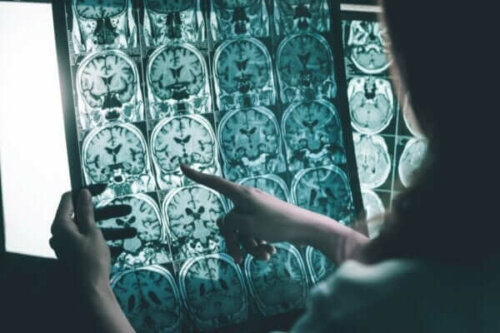 Gehirnwellenstimulation für Menschen mit Alzheimer
