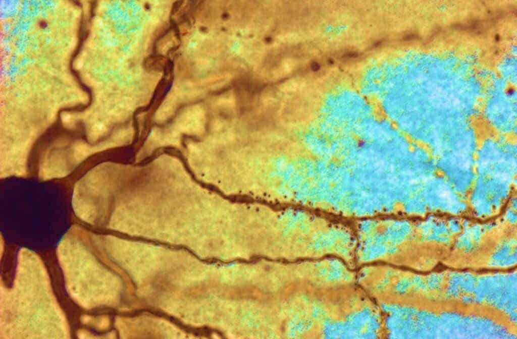 Intelligente Menschen haben größere Neuronen