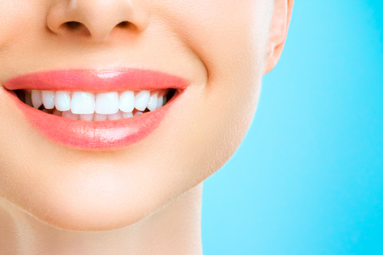 Blancorexie: die gefährliche Besessenheit von weißen Zähnen
