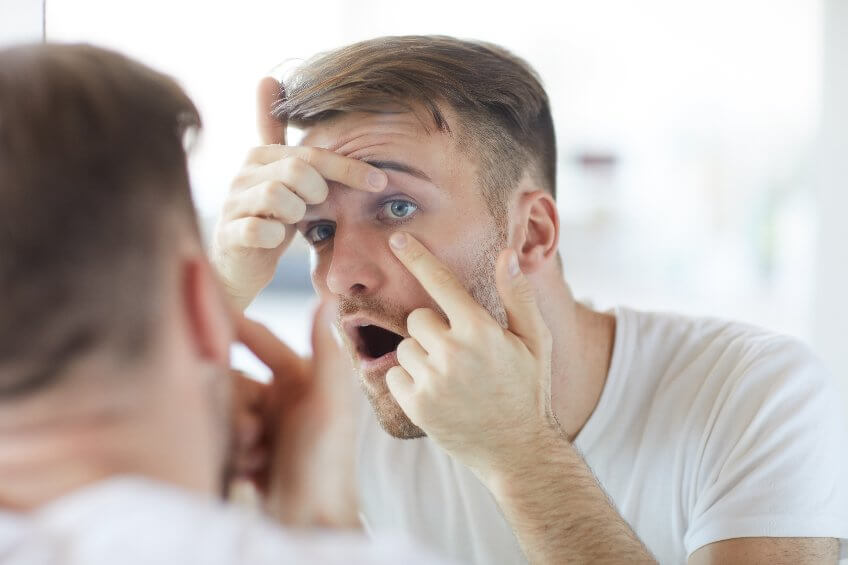 Mann setzt Monatslinsen ein